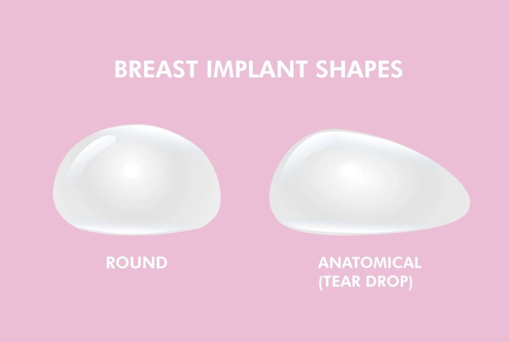 Types of Breast Implants